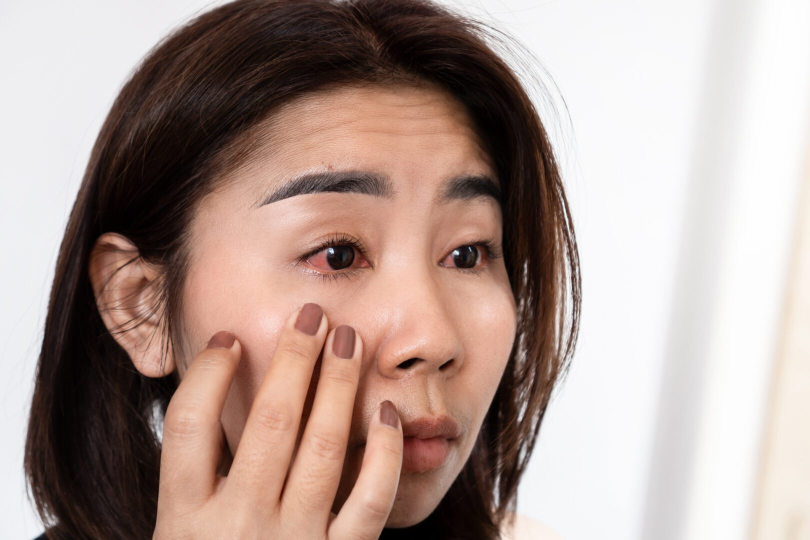 Asian woman suffering from eye inflammation feeling pain ,redness and swollen