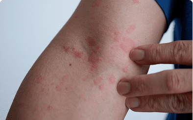 benefit-14-v4_image5